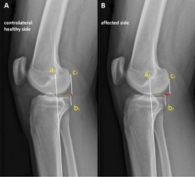 Presentation from Dr. Luca Macchiarola  (MD - Orthopaedic Surgeon)