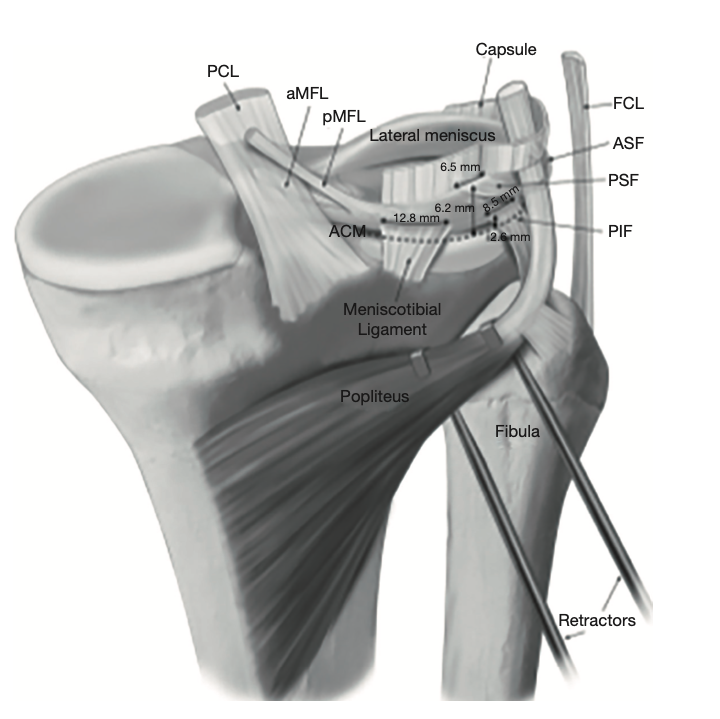 The hypermobile and unstable lateral meniscus: a narrative review of the anatomy, biomechanics, diagnosis and treatment options