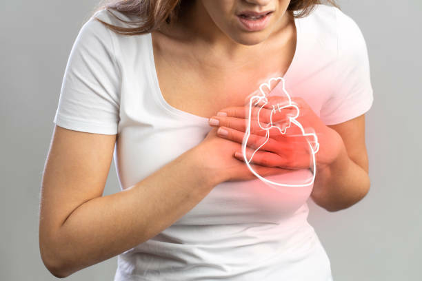 Five years-results of a nationwide database on sudden cardiac events in sports practice in Luxembourg