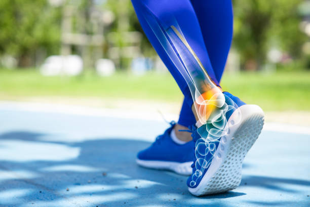 Evaluation modalities for the anatomical repair of chronic ankle instability