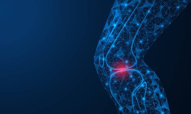 Traumatic meniscus tears