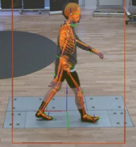 MARKERLESS MOTION CAPTURE FOR CLINICAL MOVEMENT ANALYSIS AND THE INFLUENCE OF CLOTHING ON GAIT METRICS